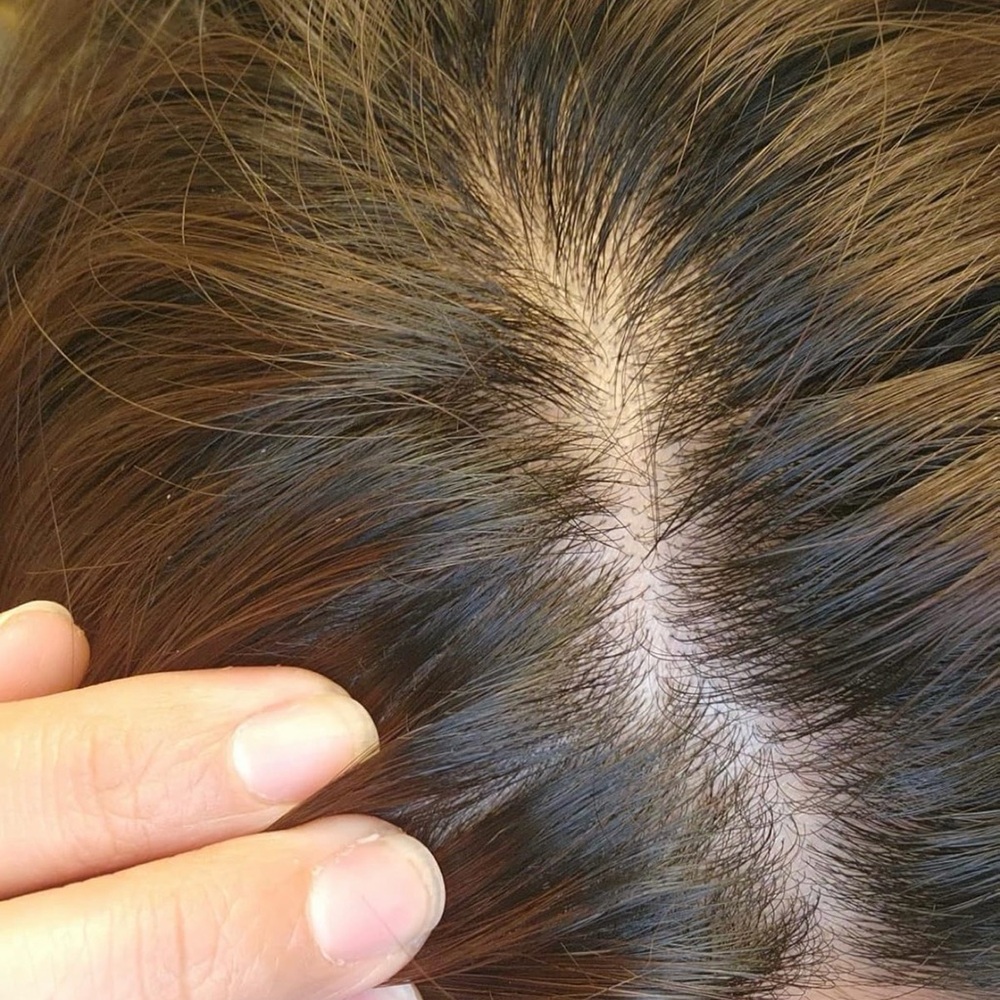 Nizoral Anti-Dandruff Shampoo - Picture 4 of 4